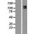 Western Blot: 160kDa Neurofilament Medium Lysate [NBL1-13578] - Western Blot experiments. 
Left-Control; Right -Over-expression Lysate for NEFM
